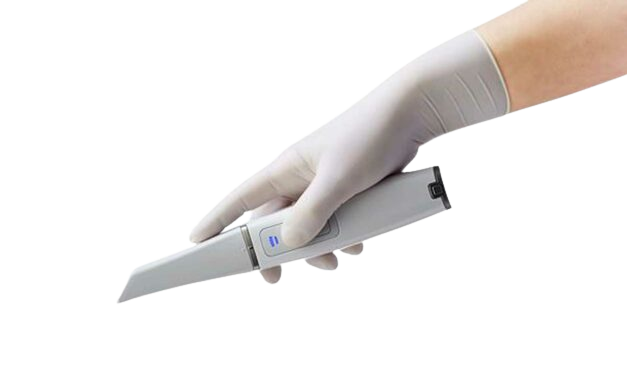 Hand with glove holding intraoral scanner device