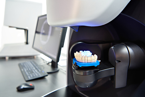 Dental 3D scanner next to computer desk scanning a plaster model.