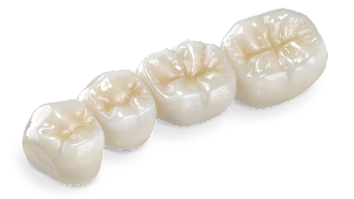 Full zirconia bridge