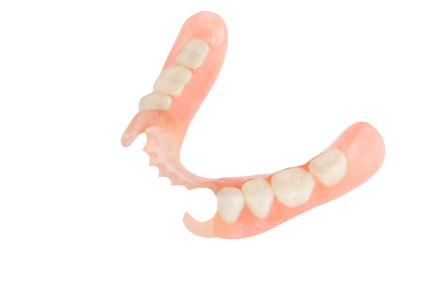 Removable flexible partial denture