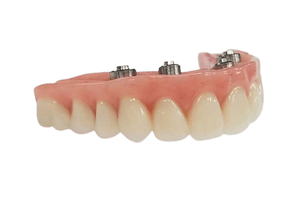 Hybrid acrylic denture all-on-4 implant abutments