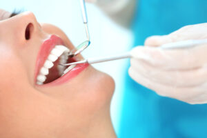 6 Different Kinds Of Dental Mixing Tips