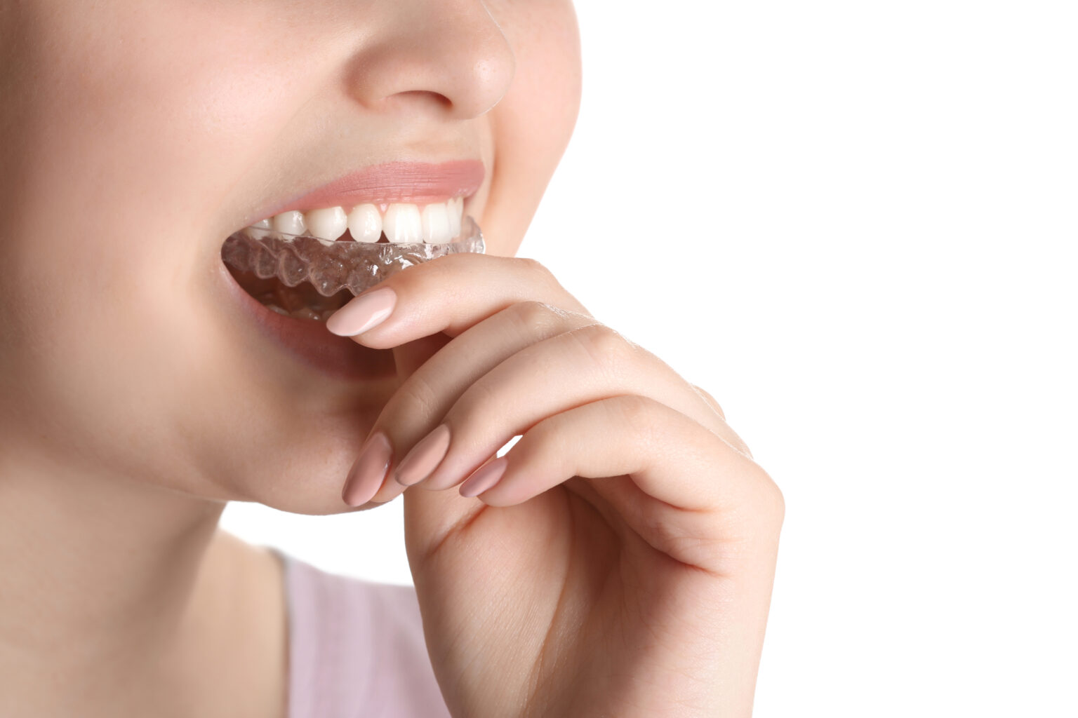 NTI Vs. Night Guard: What's The Difference? - Next Dental Lab