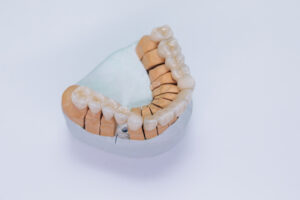 zirconia-vs-titanium-dental-implants-whats-the-difference