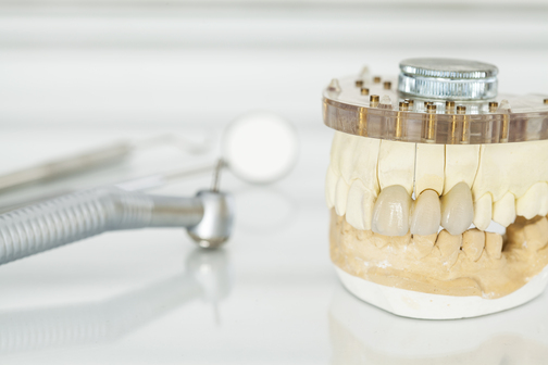 How Long Do Zirconia Crowns Last?