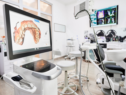 Why Intraoral Scanners Are Must-Have Equipment For A Modern Dental Office