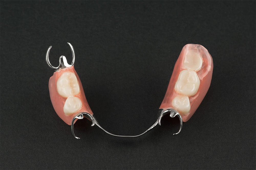 get-to-know-vitallium-2000-dentures