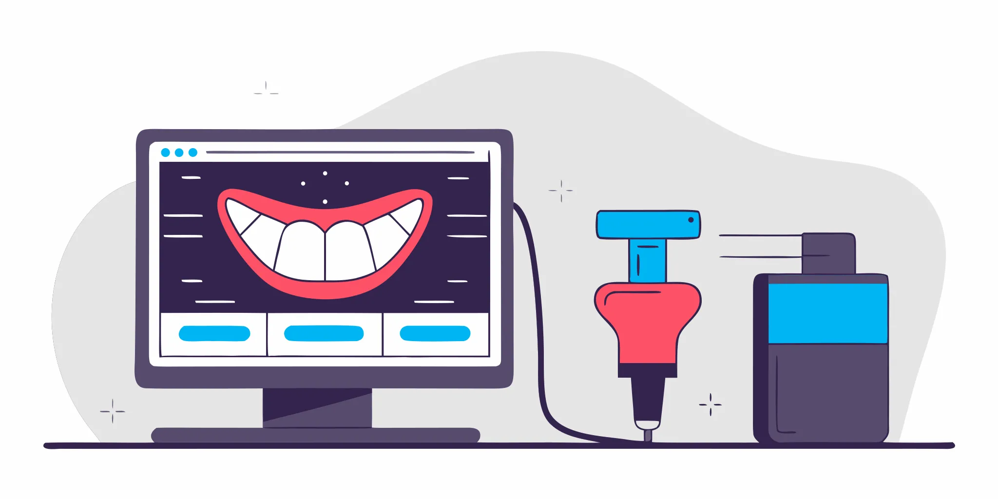 Digital vs conventional dental impressions comparison illustration